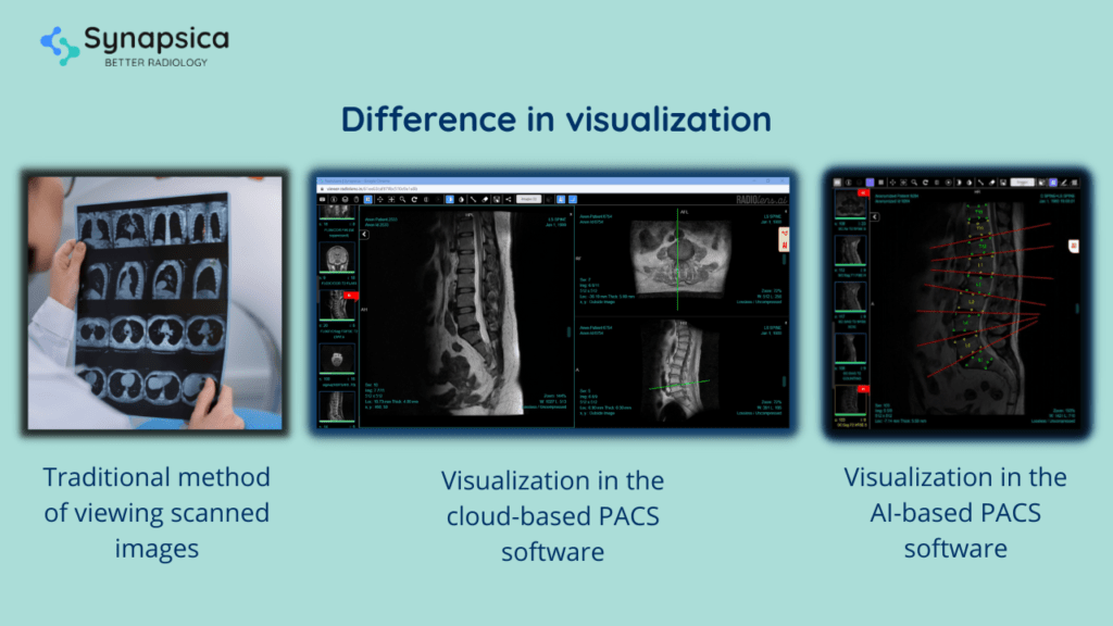Difference in image visualization