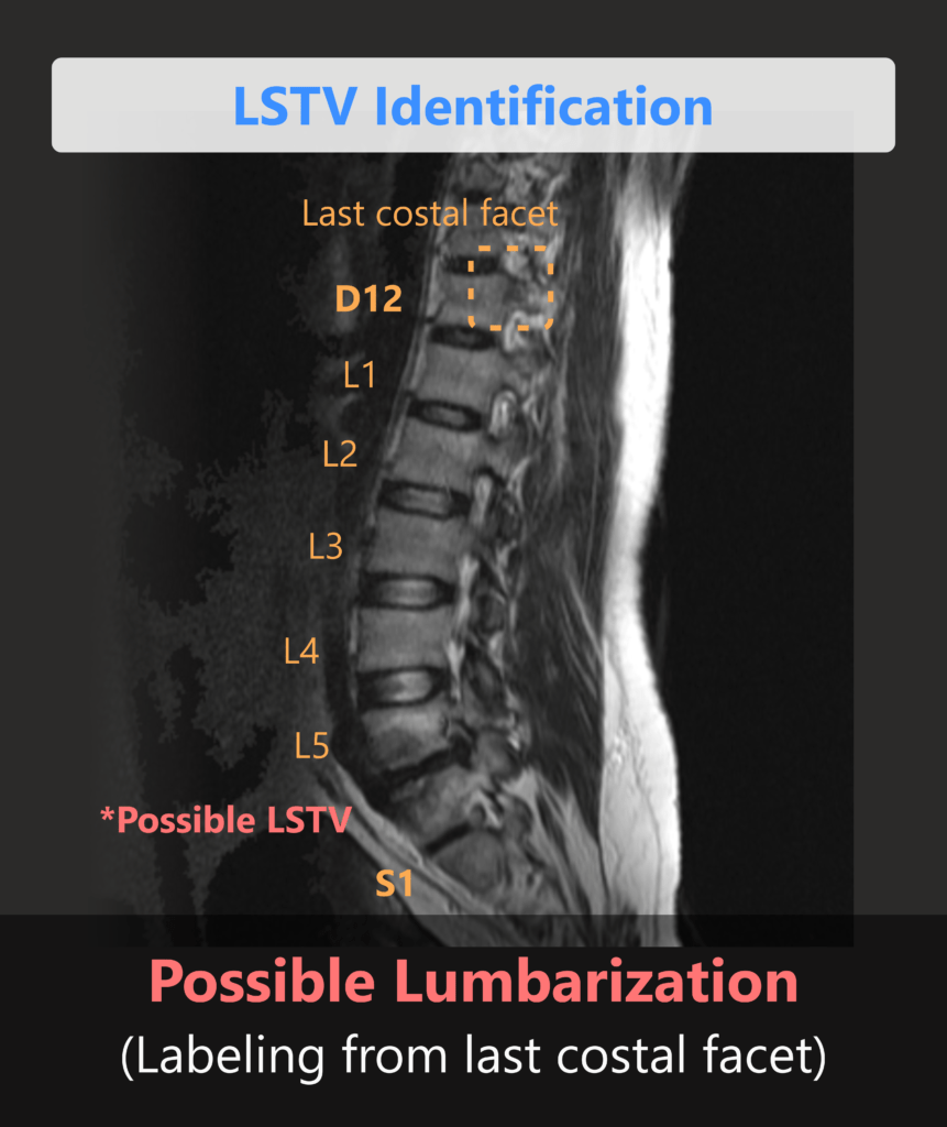 Spindle by Synapsica | AI Assistant for MRI Spine Reporting