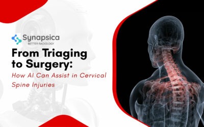 Role of AI in triaging and reporting of Cervical Spine Injuries