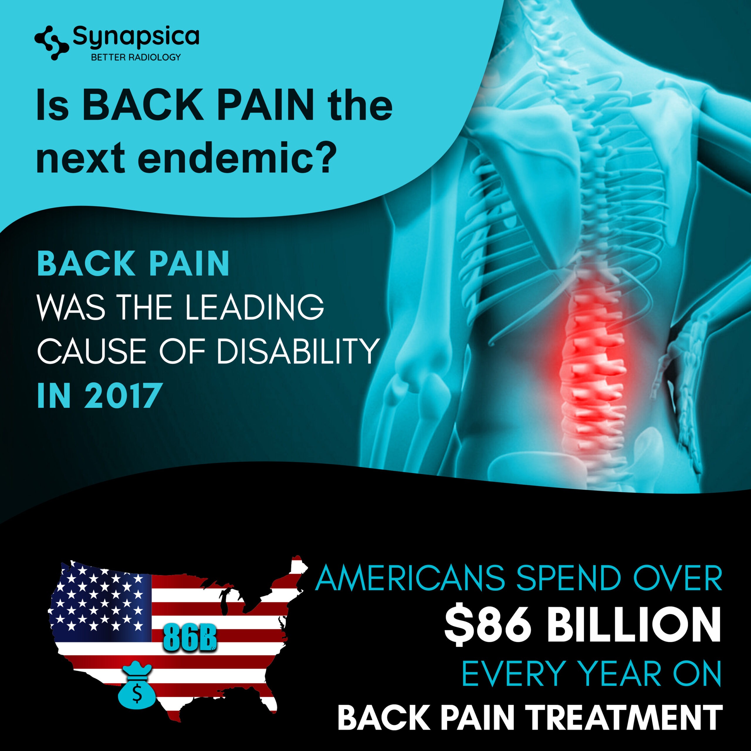 Is back pain going to be the next endemic?