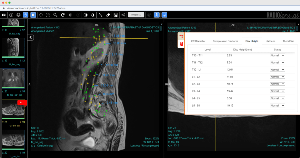 Quantitative image analysis using Spindle