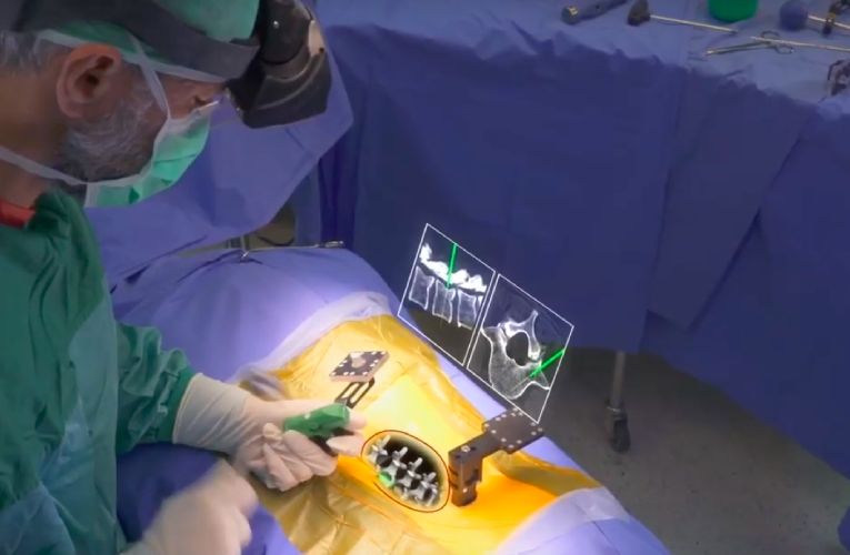 Spine Surgeries with Augmented Reality | Synapsica