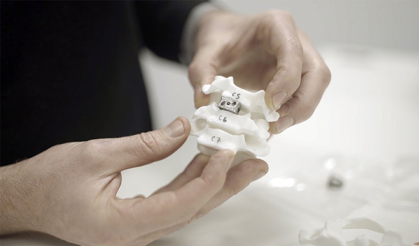 3D printing in Spine Surgeries | Synapsica